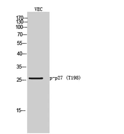 p27 (phospho Thr198) rabbit pAb - image 1