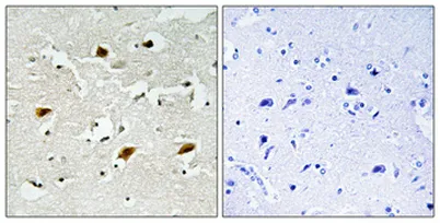 p27 (phospho Thr157) rabbit pAb - image 1
