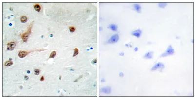 ADAR1 rabbit pAb - image 1