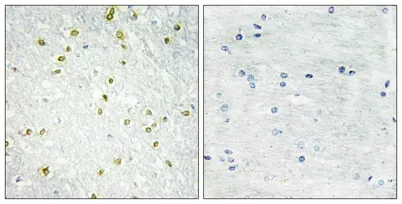 SNAPC 19 rabbit pAb - image 1
