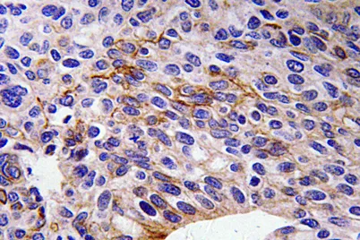 SEMA3A rabbit pAb - image 1