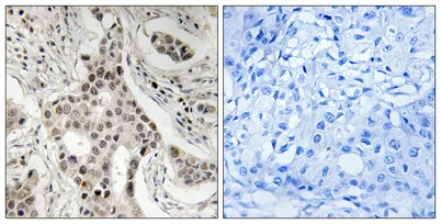 GRIP-1 (phospho Ser736) rabbit pAb - image 1