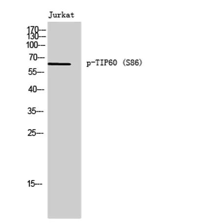 TIP60 (phospho Ser86) rabbit pAb - image 1
