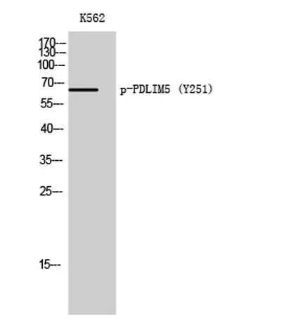 PDLIM5 (phospho Tyr251) rabbit pAb - image 1
