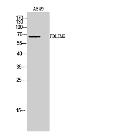 PDLIM5 rabbit pAb - image 1