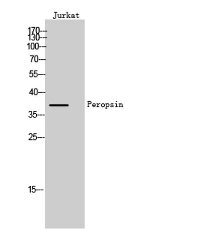 Peropsin rabbit pAb