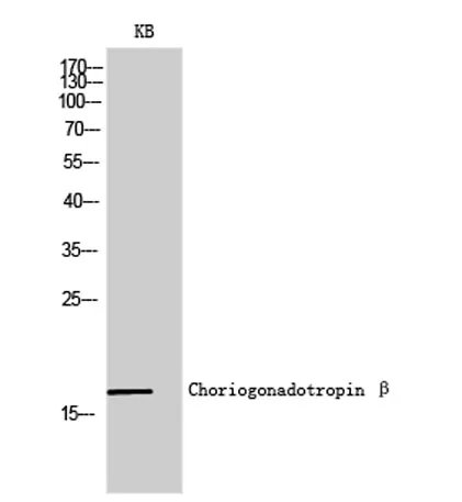 Choriogonadotropin β rabbit pAb - image 1