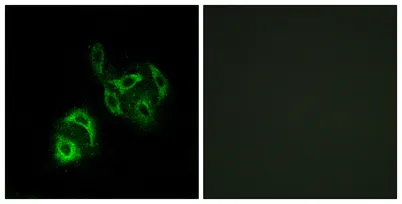 ACSVL4 rabbit pAb