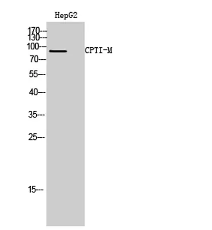 CPTI-M rabbit pAb - image 1