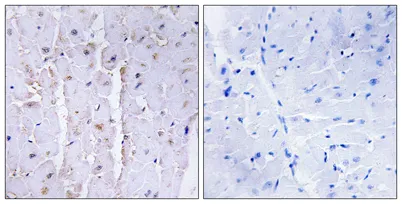 AKAP 13 rabbit pAb - image 1