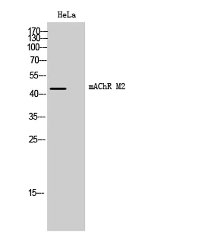 mAChR M2 rabbit pAb - image 1