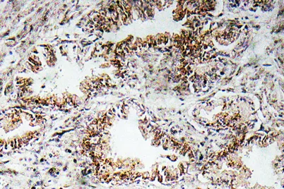 AChRα1 rabbit pAb - image 1