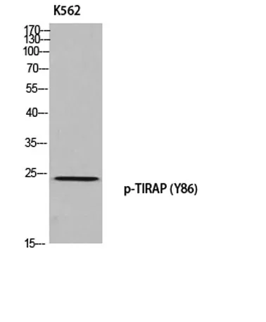 TIRAP (phospho Tyr86) rabbit pAb - image 1