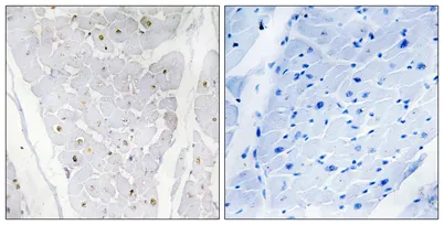 Alpha-protein Kinase 2 rabbit pAb - image 1