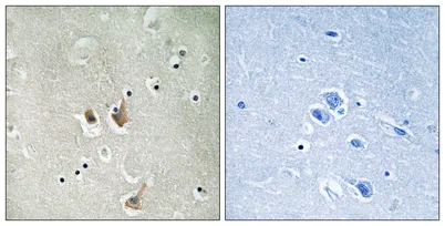 Cks2 rabbit pAb - image 1
