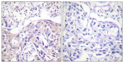Adducin α (phospho Thr445) rabbit pAb - image 1
