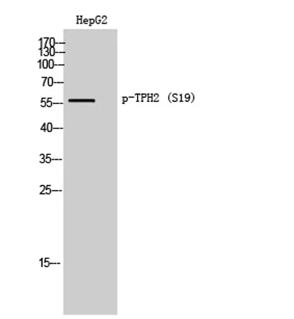 TPH2 (phospho Ser19) rabbit pAb - image 1