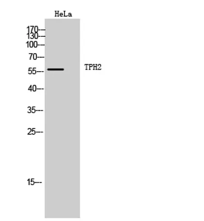 TPH2 rabbit pAb - image 1