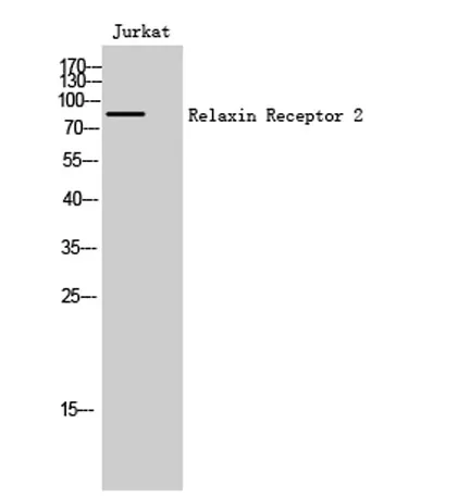Relaxin Receptor 2 rabbit pAb - image 1