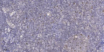 JDP2 (phospho Thr148) rabbit pAb - image 1