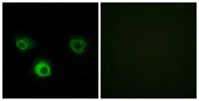 CKR-4 rabbit pAb - image 1