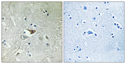 CKR-5 rabbit pAb - image 1