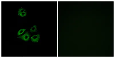 Chemokine Receptor D6 rabbit pAb