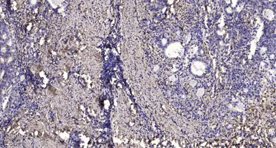 TRAPPC5 rabbit pAb - image 1