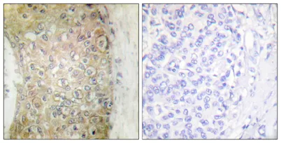 HSP20 rabbit pAb