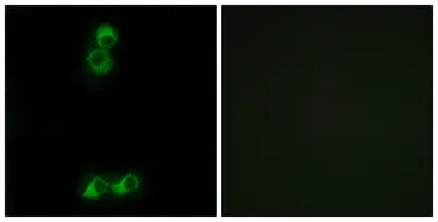 Olfactory receptor 10J5 rabbit pAb