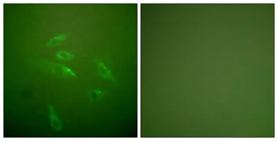 COL3A1 rabbit pAb - image 1