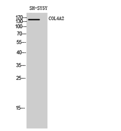 COL4A2 rabbit pAb - image 1