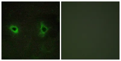 COL4A3 rabbit pAb - image 1