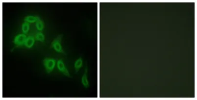 COL5A2 rabbit pAb - image 1