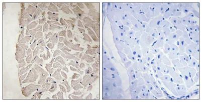 COL6A1 rabbit pAb - image 1