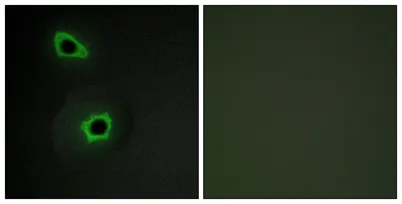 COL7A1 rabbit pAb - image 1