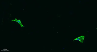 COL11A1 rabbit pAb - image 1