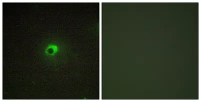 ACTR-IC rabbit pAb - image 1