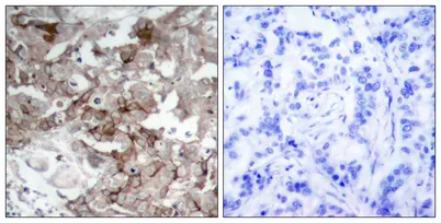 Cortactin rabbit pAb - image 1