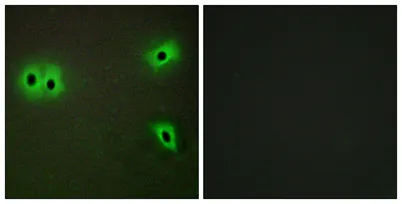 COL13A1 rabbit pAb - image 1