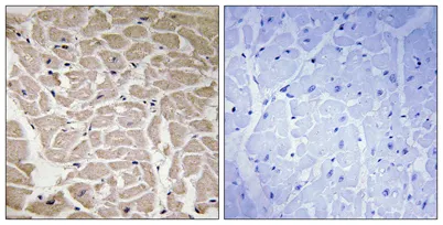 COL16A1 rabbit pAb