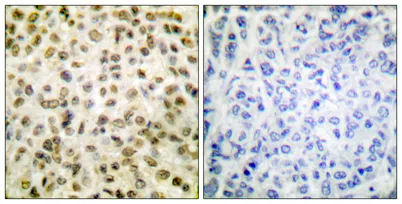 Acetyl Histone H1 (K25) rabbit pAb - image 1