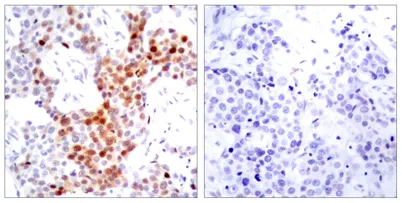 ATF-2 (phospho Thr69) rabbit pAb - image 1