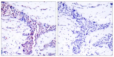 ATF-2 rabbit pAb - image 1