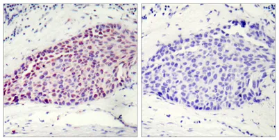 ATF-2 rabbit pAb - image 1