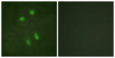 ATF-2 rabbit pAb - image 1