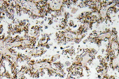 CRF rabbit pAb - image 1