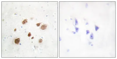 CaMKIβ rabbit pAb