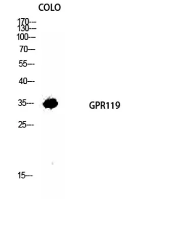 GPR119 rabbit pAb