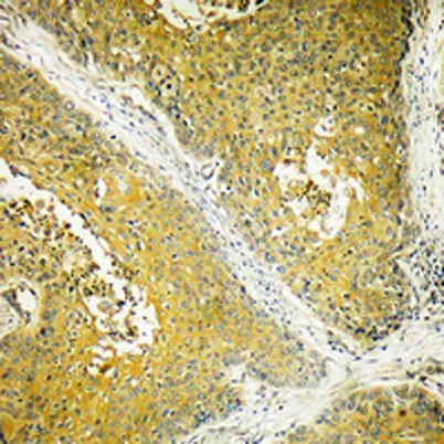 Dynein LC 2 rabbit pAb